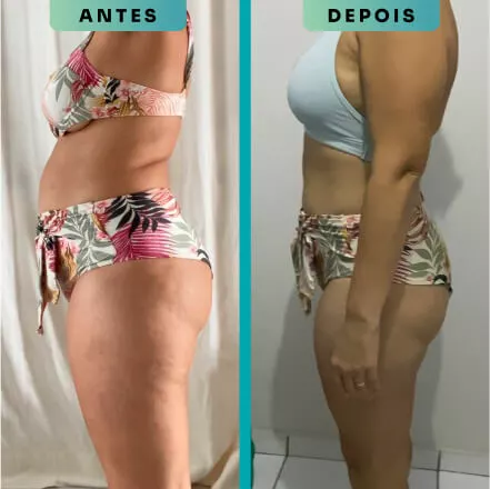 Thiago Sampaio Nutricionista - Resultado de aluna